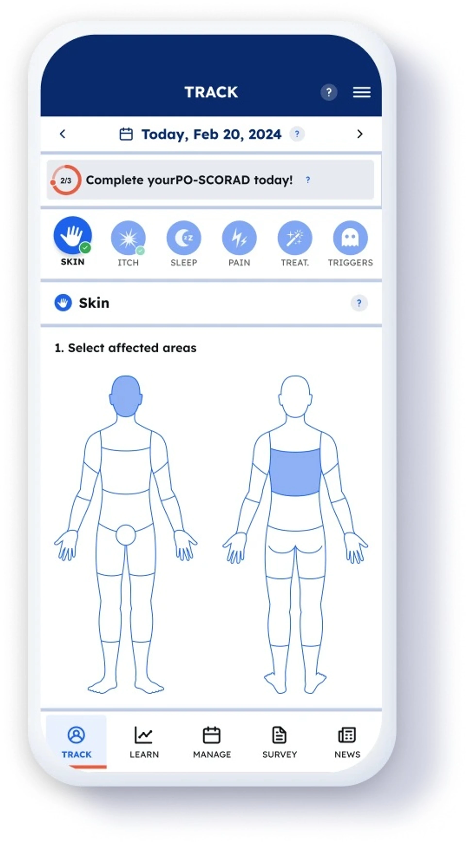 Abordagens alternativas para o tratamento do eczema crônico das mãos