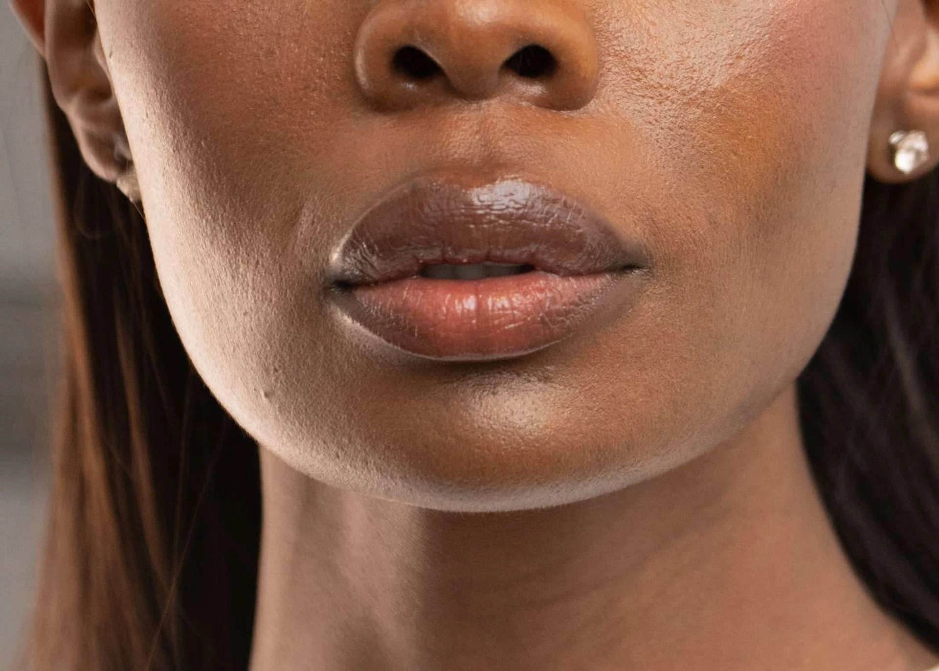 Causas da hiperpigmentação labial e tratamento dos lábios escuros